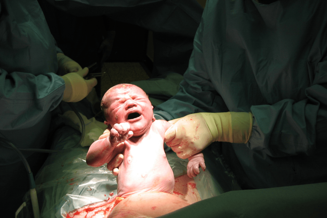 Understanding normal and caesarean delivery