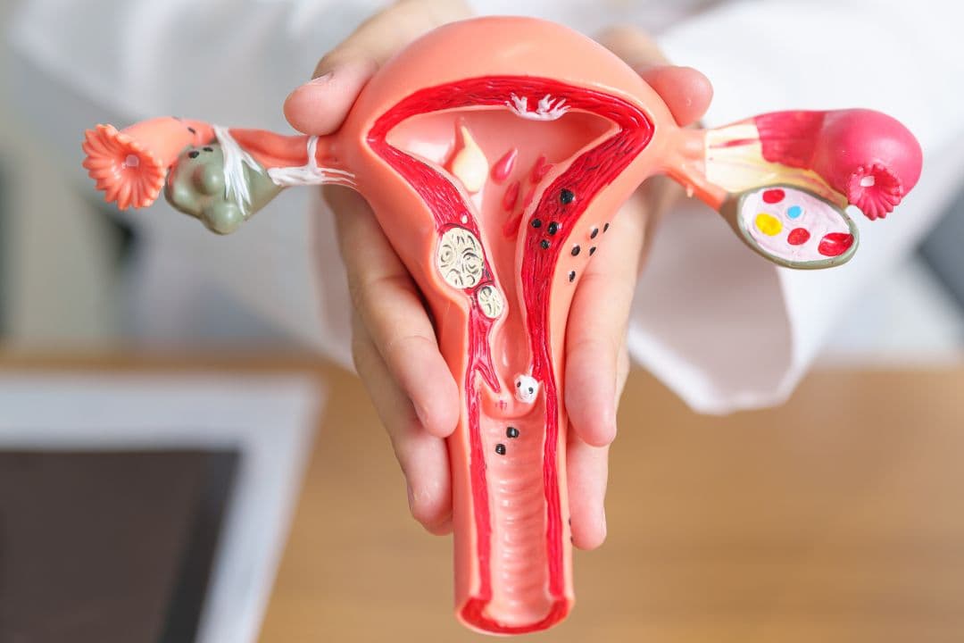 Laparoscopic and vaginal hysterectomy
