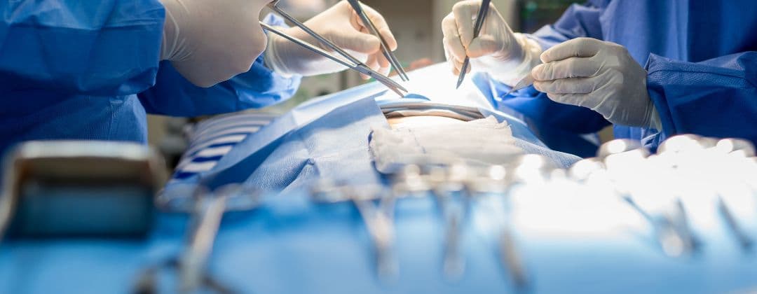 Laparoscopic Hysterectomy