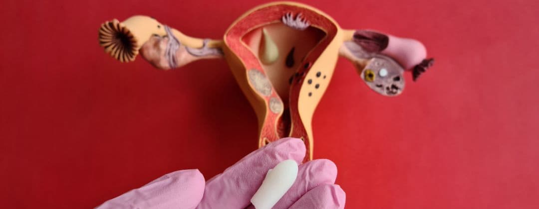 Vaginal Hysterectomy