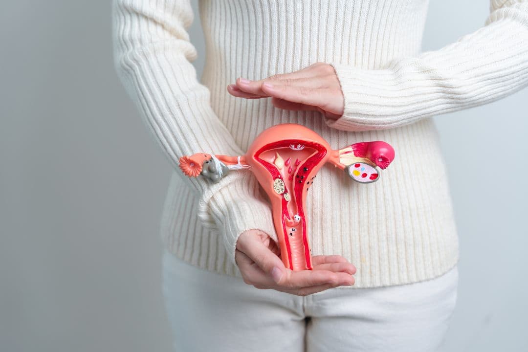 Uterine Fibroids