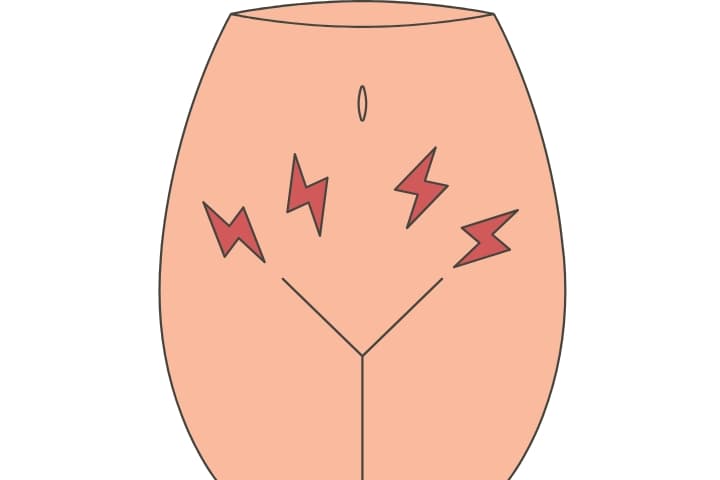 Hymenoplasty consultation